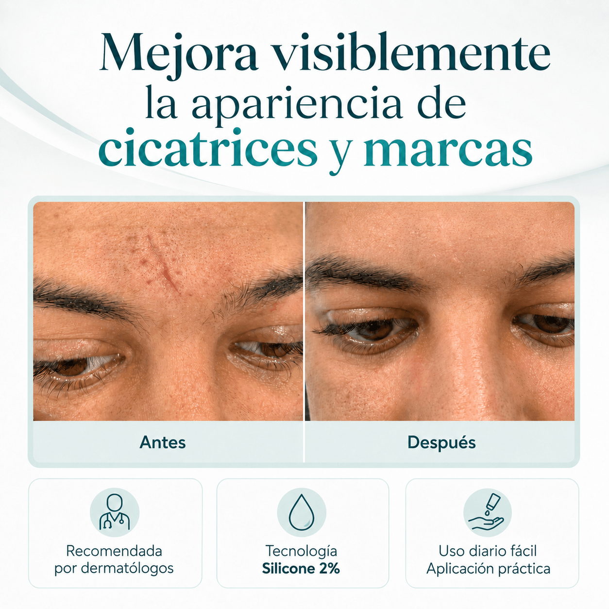 SILICONE SCAR CREAM
